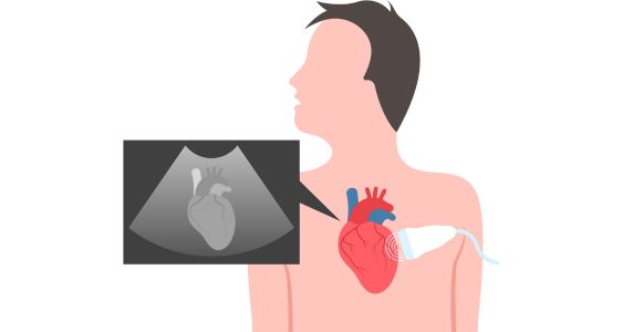 The Prevalence of Congenital Heart Defects